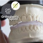 Orthodontic Splint
